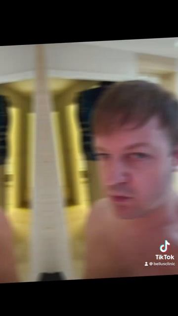 Результат пересадки волос на обширное облысение - рез?