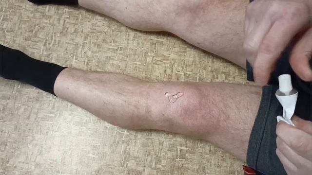 Ручка лейки.19 день после травмы колена и на следующий ?