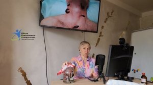 Почему на пиявке появляются перетяжки? Можно ли стави?