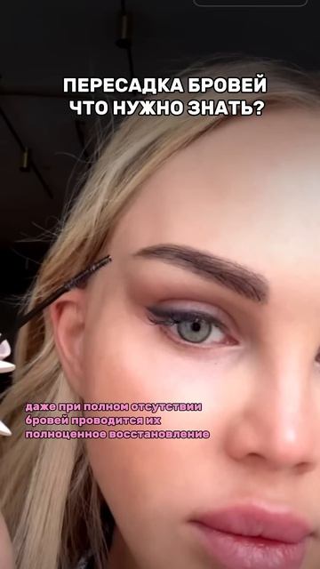 Пересадка бровей одинаково успешна и для женщин, и для