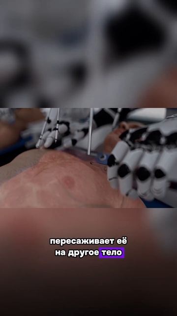 Пересадка головы - новая реальность? смотреть онлайн