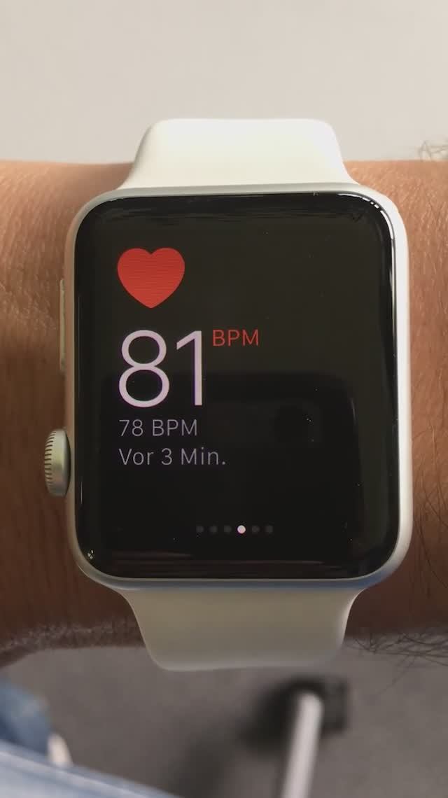 Как Apple Watch спасли жизнь человеку! смотреть онлайн