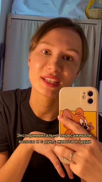 Можно ли с НОГ пересадить волосы на голову ? #трансплан смотреть онлайн