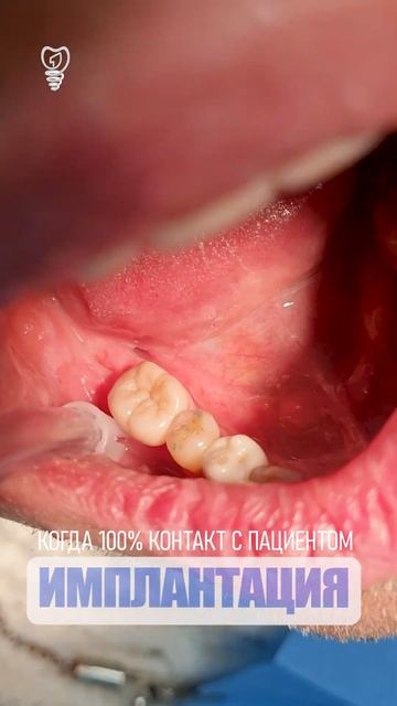 Когда с пациентом 100% контакт. When There Is 100% Contact With The Patient.