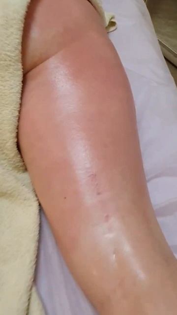 Результат антицеллюлитного массажа смотреть онлайн