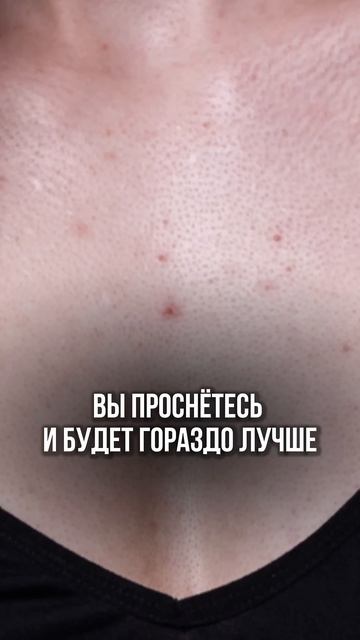 Как убрать прыщи дома 👆 #уходзасобой  #уходзакожей  #п?