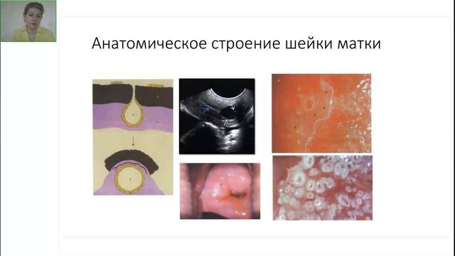 Кольпоскопия — Анатомическое и гистологическое стро? смотреть онлайн