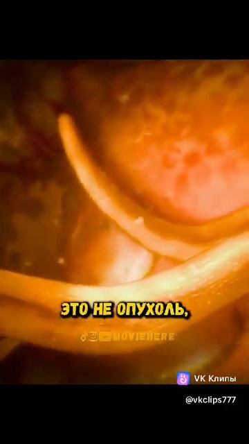 Очнитесь! Организм дает знаки! Разные!И выход есть! Это смотреть онлайн