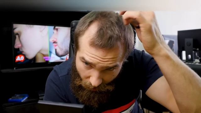 Как скрыть лысину и залысины на лбу? Прическа с лобным? смотреть онлайн