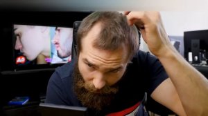 Как скрыть лысину и залысины на лбу? Прическа с лобным?