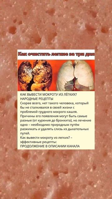 a КАК ВЫВЕСТИ МОКРОТУ ИЗ ЛЁГКИХ НАРОДНЫЕ РЕЦЕПТЫ смотреть онлайн