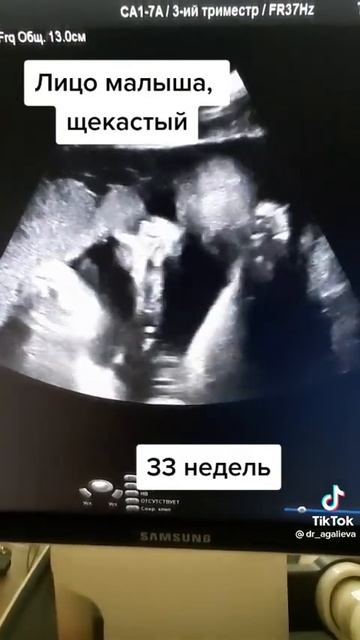 33 неделя. 33 урок. 9 класс биологии🪱 смотреть онлайн