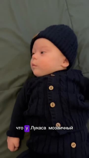 Мозаичный синдром Дауна - счастье или страдание? #мног? смотреть онлайн