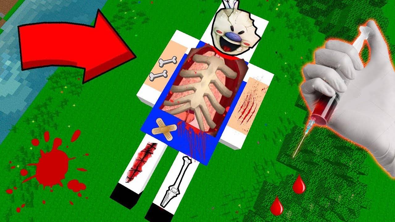 МОРОЖЕНЩИК ЗАБОЛЕЛ И ЕМУ СРОЧНО НУЖНА ОПЕРАЦИЯ В МАЙНКРАФТ ФИЛЬМ SCP ICE SCREAM СИМУЛЯТОР ХИРУРГА смотреть онлайн