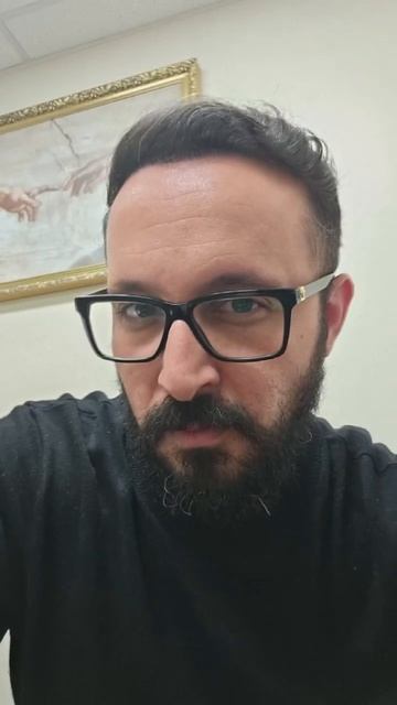 До и после пересадки волос #пересадкаволос #пересадка? смотреть онлайн