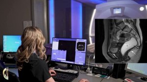 МРТ органов малого таза