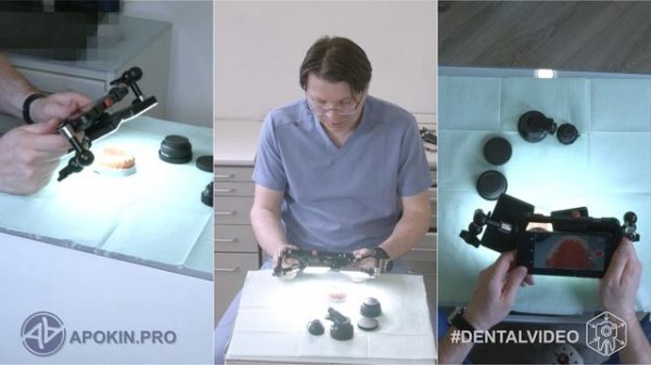 Сборка комплекта для съемки со сменной оптикой - Mobile Dental Video Rig - Часть 3 #dentalvideo 4K
