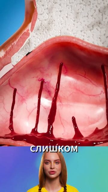 Почему идет кровь из носа? смотреть онлайн