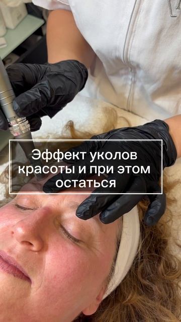 Большинство проблем — рубцы, расширенные поры, атрофи смотреть онлайн