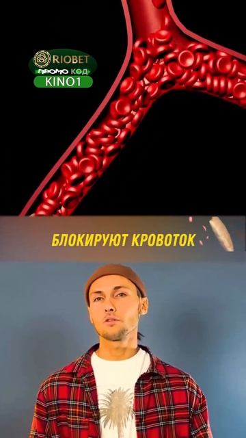 Почему у борцов такие уши? смотреть онлайн