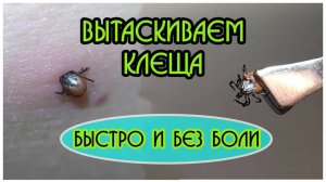 Как быстро вытащить клеща у человека