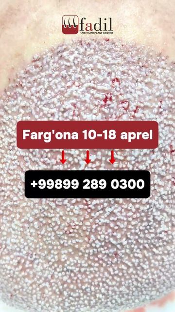 ⚡️ Фарғона филиалимизда навбатдаги амалиётлар 10-18 ап
