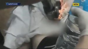 Мужик из Запорожья проснулся с гайкой на члене