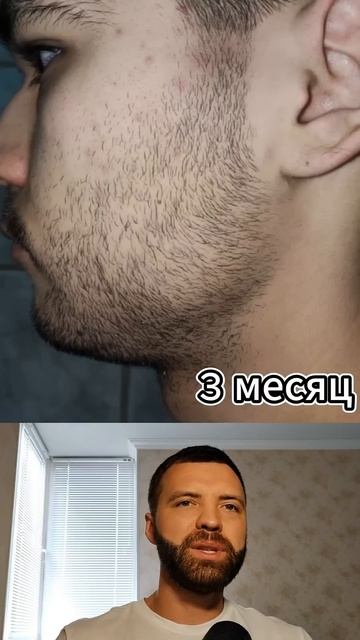 запустил рост бороды в 20 лет. результаты до и после Анд смотреть онлайн