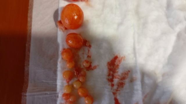 как развиваются яйца у птицы.