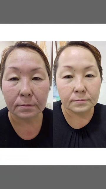 массаж лица 🤗 наш результат 🤩 смотреть онлайн