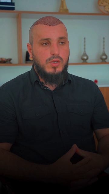 Отзыв пациента о пересадке волос // REAL MED HAIR смотреть онлайн