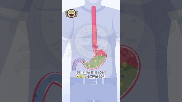 Как избавиться от гипертонии без таблеток?