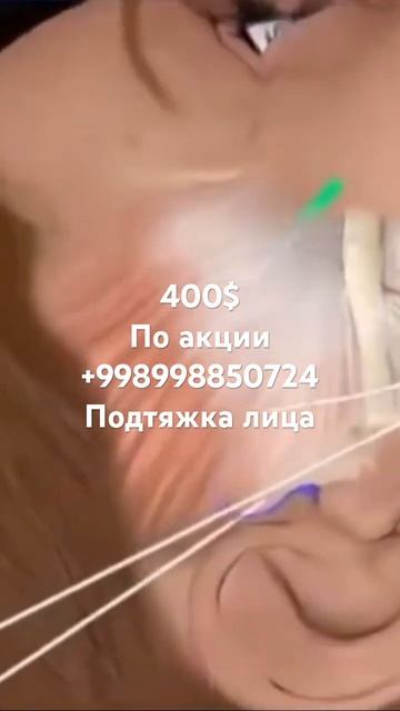 Подтяжка лица акция 400$ +998998850724 #dance #fashion #challenge #greenscreen #fu смотреть онлайн