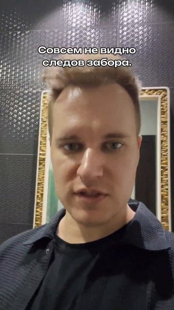 10 месяцев после пересадки волос смотреть онлайн