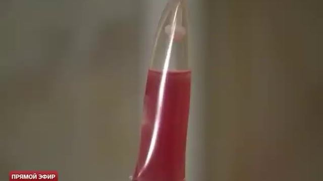 500 пересадка КМ смотреть онлайн