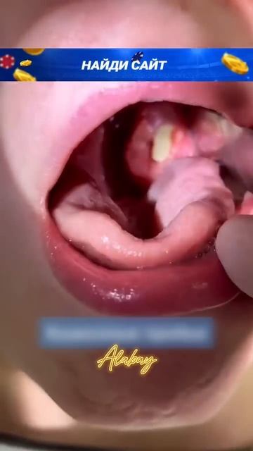 😱Это может быть у тебя во рту🤢 #alabay смотреть онлайн