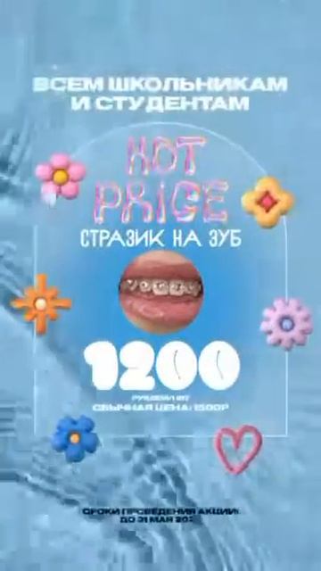 Стразик 💎 #красота #улыбка #школьник #студенты #зубы #а