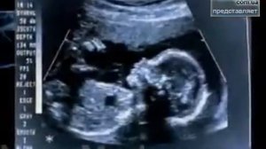 фильм 'Паразиты' часть 1 из 3