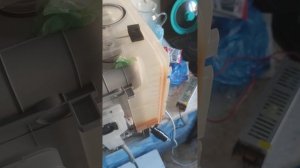 Ошибка E1 на Maunfeld MWF06IM