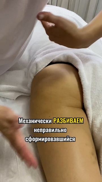 Зачем нужен антицеллюлитный массаж? смотреть онлайн