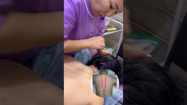 Точечный массаж спины. смотреть онлайн