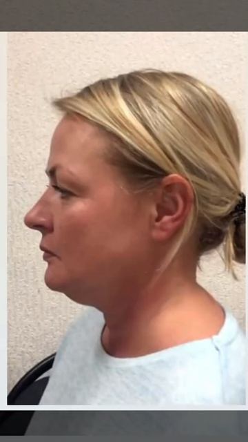 Массаж лица 3d #массаж #массажлица #массажобучение смотреть онлайн