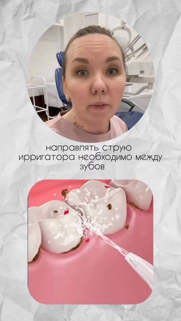 ИРРИГАТОР, как правильно применять? 🧑🏼🎓 смотреть онлайн