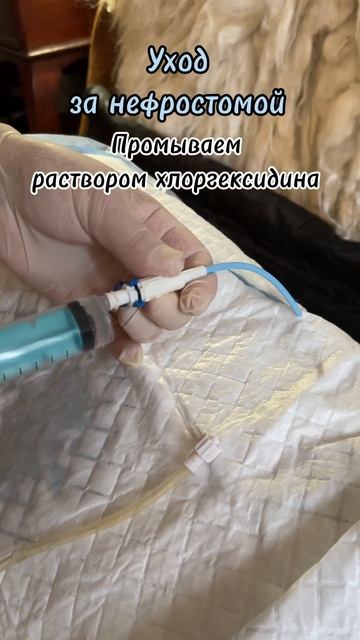 Ежедневный уход | Нефростома инструкция к применению # смотреть онлайн
