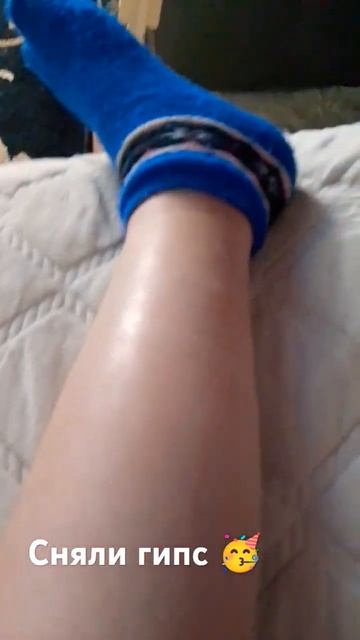 Мне сняли гипс #shortvideo #mrbeast #rideaction #гипс смотреть онлайн