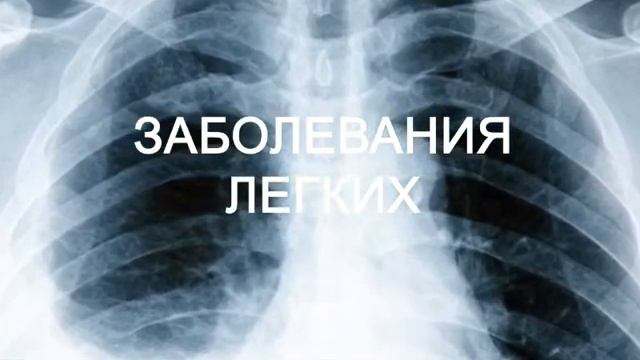 РЕВМАТОИДНЫЙ АРТРИТ ДАВОЛАШ смотреть онлайн