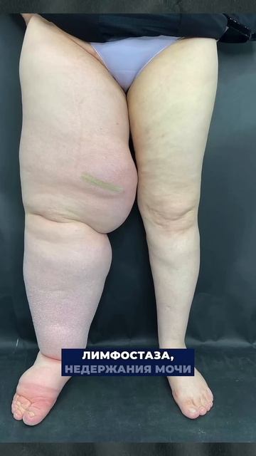 Это одна из причин рака! #диета #здоровье #похудение #по смотреть онлайн