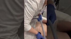 Техника выполнения вакуумного массажа зоны живота