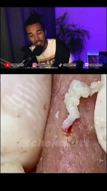 Как правильно делать массаж лица дома? #chokotutt #черныйст смотреть онлайн