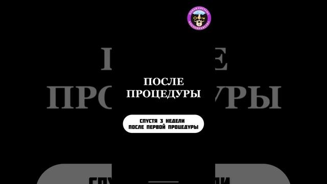 Многолетняя боль 😣 в пояснице, Костоправ г.Екатеринб? смотреть онлайн